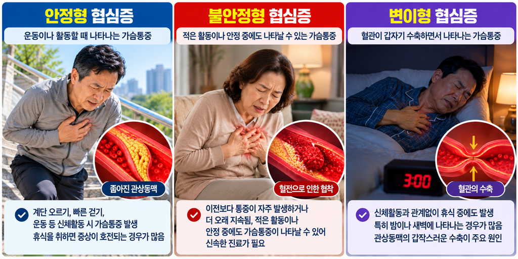 계단 오를 때 가슴이 조인다면?|협심증 증상부터 치료방법까지 총정리 종류